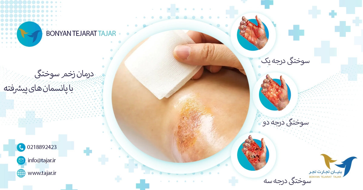 Treating burns with advanced dressings