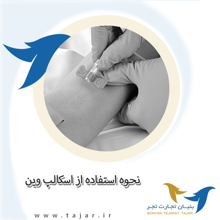 نحوه استفاده از اسکالپ وین
