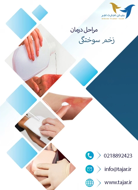 مراحل درمان زخم سوختگی
