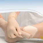 پانسمان زخم دیابتی؛ انواع و درمان آن در منزل
