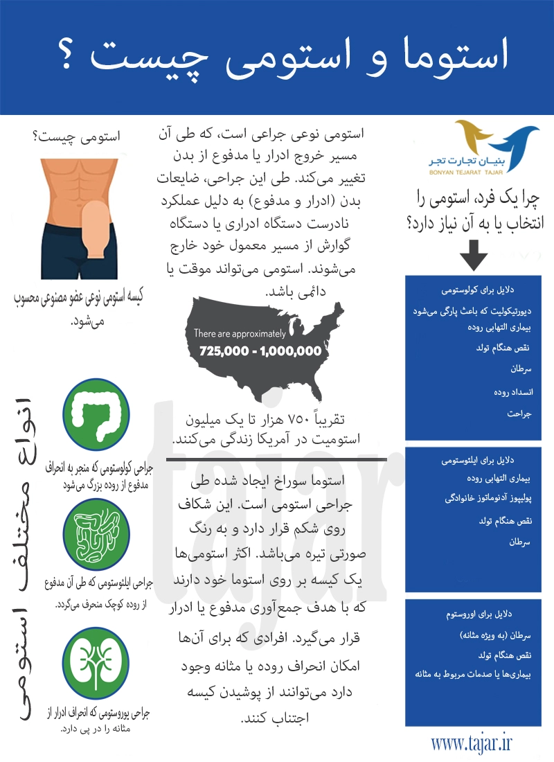 استوما و استومی چیست ؟