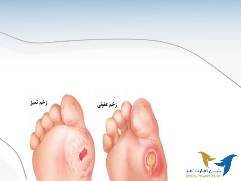 از چیستی تا درمان زخم عفونی